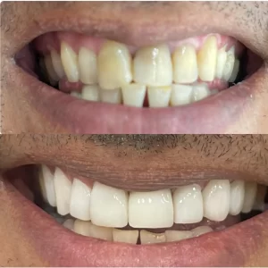 Result facetas 2